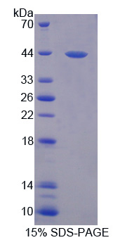 环指蛋白55(RNF55)重组蛋白,Recombinant Ring Finger Protein 55 (RNF55)