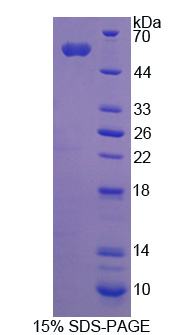 活性依赖性神经保护因子(ADNP)重组蛋白,Recombinant Activity Dependent Neuroprotector Protein (ADNP)