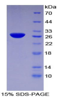 組織因子通道抑制因子2(TFPI2)重組蛋白,Recombinant Tissue Factor Pathway Inhibitor 2 (TFPI2)