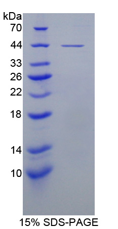 組織內(nèi)轉(zhuǎn)化生長因子β結(jié)合蛋白1(LTBP1)重組蛋白,Recombinant Latent Transforming Growth Factor Beta Binding Protein 1 (LTBP1)