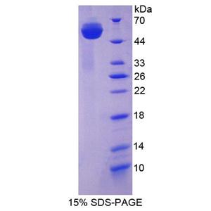 亨廷頓關(guān)聯(lián)蛋白1(HAP1)重組蛋白,Recombinant Huntingtin Associated Protein 1 (HAP1)