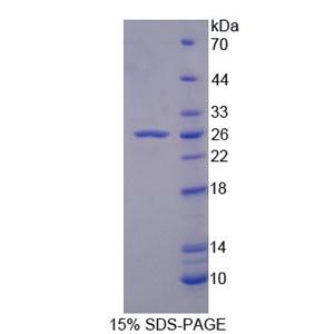 亨廷顿相互作用蛋白2(HIP2)重组蛋白,Recombinant Huntingtin Interacting Protein 2 (HIP2)