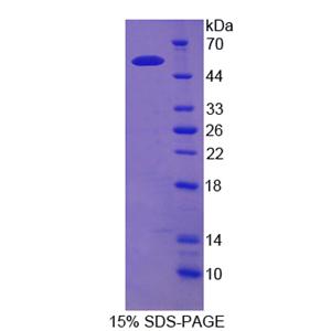 红细胞膜蛋白带4.2(EPB42)重组蛋白,Recombinant Erythrocyte Membrane Protein Band 4.2 (EPB42)