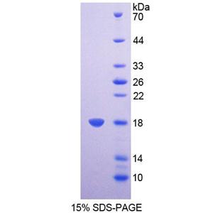 琥珀酸脱氢酶复合体D亚基(SDHD)重组蛋白,Recombinant Succinate Dehydrogenase Complex Subunit D (SDHD)