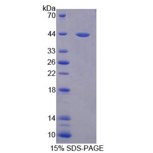 环指蛋白55(RNF55)重组蛋白,Recombinant Ring Finger Protein 55 (RNF55)