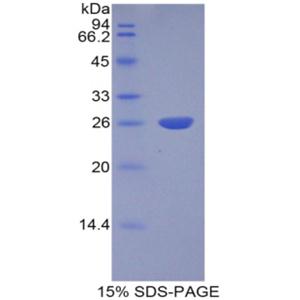 组织蛋白酶S(CTSS)重组蛋白,Recombinant Cathepsin S (CTSS)