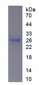 组织蛋白酶B(CTSB)重组蛋白,Recombinant Cathepsin B (CTSB)