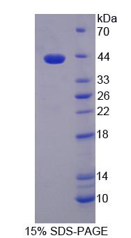 组蛋白脱乙酰基酶9(HDAC9)重组蛋白,Recombinant Histone Deacetylase 9 (HDAC9)