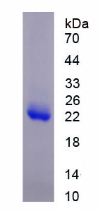 组蛋白脱乙酰基酶6(HDAC6)重组蛋白,Recombinant Histone Deacetylase 6 (HDAC6)