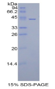组蛋白1簇H2aa(HIST1H2AA)重组蛋白,Recombinant Histone Cluster 1, H2aa (HIST1H2AA)