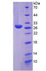 组氨酸脱羧酶(HDC)重组蛋白,Recombinant Histidine Decarboxylase (HDC)