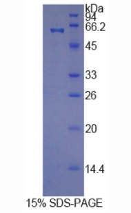 组氨酸丰富糖蛋白(HRG)重组蛋白,Recombinant Histidine Rich Glycoprotein (HRG)