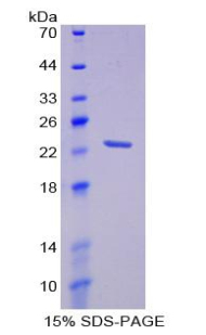 棕榈酰化膜蛋白6(MPP6)重组蛋白,Recombinant Membrane Protein, Palmitoylated 6 (MPP6)