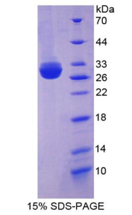 棕櫚?；さ鞍?(MPP5)重組蛋白,Recombinant Membrane Protein, Palmitoylated 5 (MPP5)