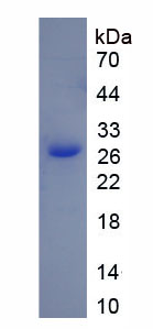 自噬相关蛋白7(ATG7)重组蛋白,Recombinant Autophagy Related Protein 7 (ATG7)