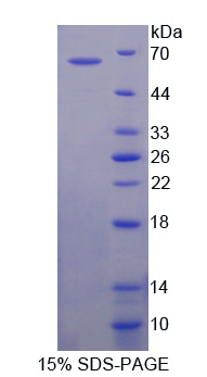 自噬相關(guān)16樣蛋白1(ATG16L1)重組蛋白,Recombinant Autophagy Related Protein 16 Like Protein 1 (ATG16L1)