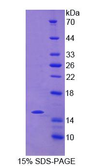 自然细胞毒性触发受体2(NCR2)重组蛋白,Recombinant Natural Cytotoxicity Triggering Receptor 2 (NCR2)