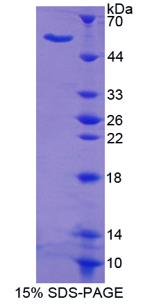 转移关联蛋白1(MTA1)重组蛋白,Recombinant Metastasis Associated Protein 1 (MTA1)