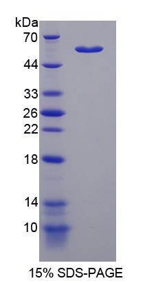 转酮醇酶样蛋白1(TKTL1)重组蛋白,Recombinant Transketolase Like Protein 1 (TKTL1)