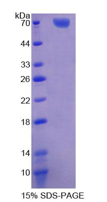 转录因子Dp1(TFDP1)重组蛋白,Recombinant Transcription Factor Dp1 (TFDP1)