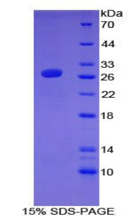 轉(zhuǎn)錄激活因子7(ATF7)重組蛋白,Recombinant Activating Transcription Factor 7 (ATF7)