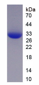 转录激活因子6(ATF6)重组蛋白,Recombinant Activating Transcription Factor 6 (ATF6)