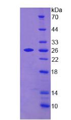 转胶蛋白2(TAGLN2)重组蛋白,Recombinant Transgelin 2 (TAGLN2)