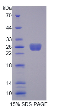 转胶蛋白(TAGLN)重组蛋白,Recombinant Transgelin (TAGLN)