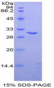 转化受体电位阳离子通道亚家族V成员6(TKL6)重组蛋白,Recombinant Transient Receptor Potential Cation Channel Subfamily V, Member 6 (TRPV6)