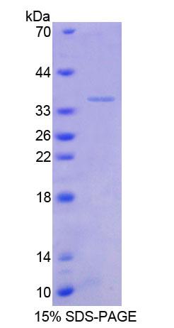 转化生长因子β刺激蛋白22(TSC22)重组蛋白,Recombinant Transforming Growth Factor Beta Stimulated Protein Clone 22 (TSC22)