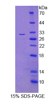 轉(zhuǎn)化/轉(zhuǎn)錄域關(guān)聯(lián)蛋白(TRRAP)重組蛋白,Recombinant Transformation/Transcription Domain Associated Protein (TRRAP)