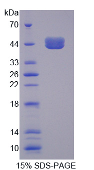 转钴胺素蛋白Ⅰ(TCN1)重组蛋白,Recombinant Transcobalamin I (TCN1)