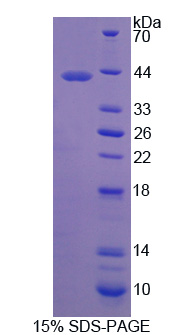 蛛毒素受体3(LPHN3)重组蛋白,Recombinant Latrophilin 3 (LPHN3)