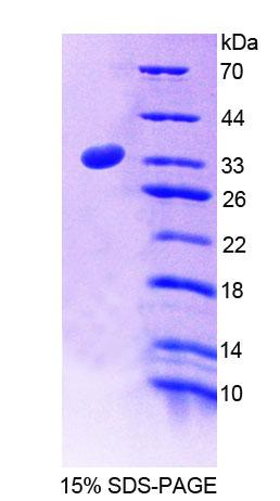 蛛毒素受体2(LPHN2)重组蛋白,Recombinant Latrophilin 2 (LPHN2)