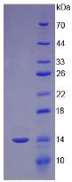 肘臀蛋白(CUBN)重組蛋白,Recombinant Cubilin (CUBN)