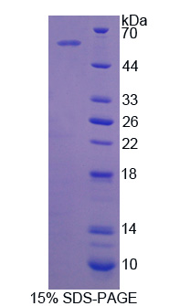 周期素依赖性激酶抑制因子3(CDKN3)重组蛋白,Recombinant Cyclin Dependent Kinase Inhibitor 3 (CDKN3)