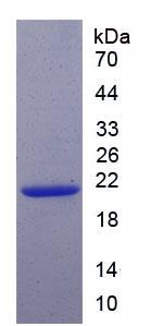 周期素依赖性激酶抑制因子1A(CDKN1A)重组蛋白,Recombinant Cyclin Dependent Kinase Inhibitor 1A (CDKN1A)