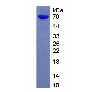 组织蛋白酶E(CTSE)重组蛋白