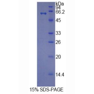 组氨酸丰富糖蛋白(HRG)重组蛋白,Recombinant Histidine Rich Glycoprotein (HRG)