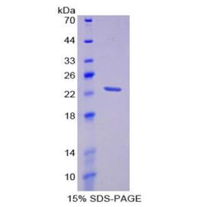 棕榈酰化膜蛋白6(MPP6)重组蛋白