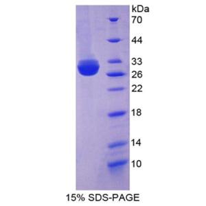 棕榈酰化膜蛋白5(MPP5)重组蛋白