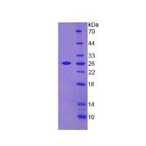 转胶蛋白2(TAGLN2)重组蛋白,Recombinant Transgelin 2 (TAGLN2)