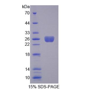 转胶蛋白(TAGLN)重组蛋白,Recombinant Transgelin (TAGLN)