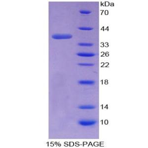 转换蛋白1(TNP1)重组蛋白,Recombinant Transition Protein 1 (TNP1)