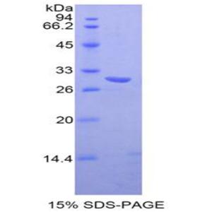 轉(zhuǎn)化受體電位陽離子通道亞家族M成員4(TKL4)重組蛋白,Recombinant Transient Receptor Potential Cation Channel Subfamily M, Member 4 (TRPM4)