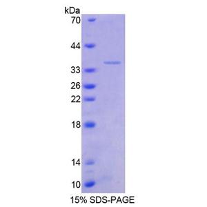 转化生长因子β刺激蛋白22(TSC22)重组蛋白