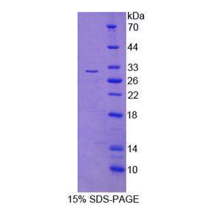 轉(zhuǎn)化/轉(zhuǎn)錄域關(guān)聯(lián)蛋白(TRRAP)重組蛋白,Recombinant Transformation/Transcription Domain Associated Protein (TRRAP)