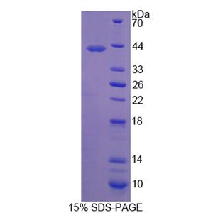 蛛毒素受体3(LPHN3)重组蛋白