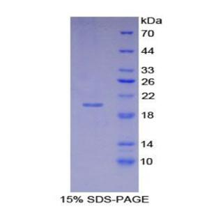 周期素依赖性激酶抑制因子2A(CDKN2A)重组蛋白