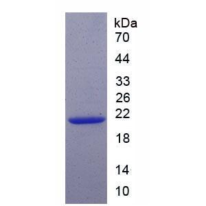 周期素依赖性激酶抑制因子1A(CDKN1A)重组蛋白